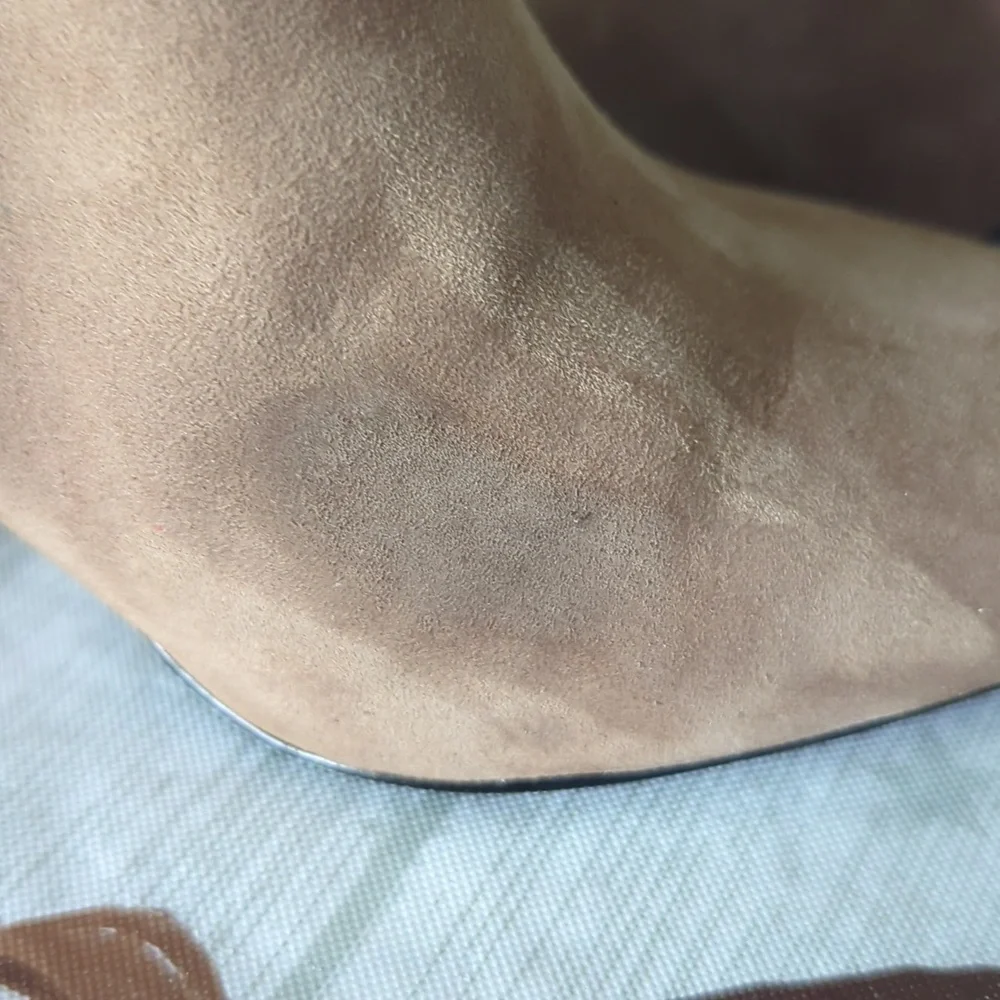 1. State state ankle
